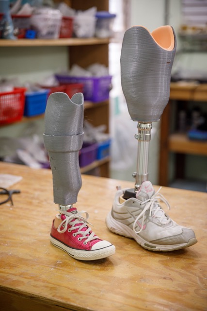 Donate - Below the Knee Prosthesis