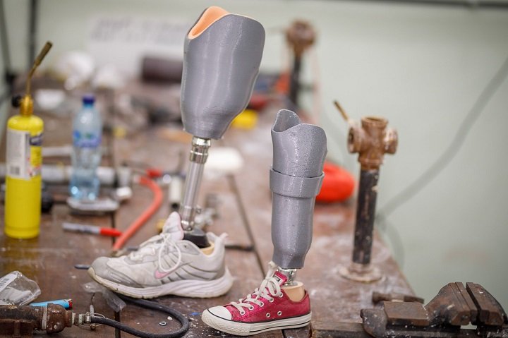 Affordable Prosthetic Care With LifeNabled